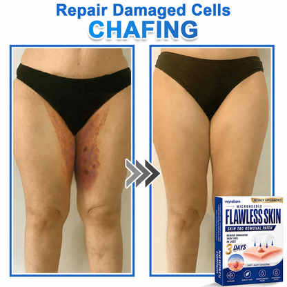 💎veyrabare® 2026 Newly Upgraded 2-in-1 Microneedle Hydrocolloid Patches | Removes Raised Moles, Acne, Flat Warts, and Skin Tags | Improves Wrinkles, Scars, and Blemishes | Invisible Acne Patches for Face & Body