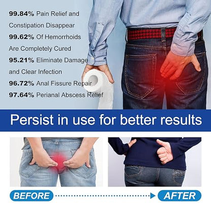 Natural Herbal Hemorrhoid Capsules – Strikes Pain & Swelling at the Root with Fast-Acting Relief: Total Body & Mind Comfort in Just 10 Days!
