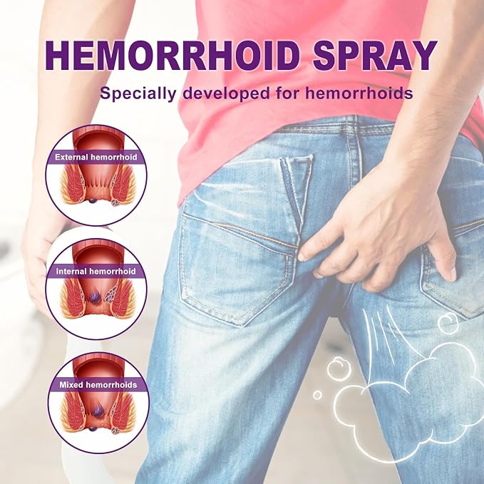Stop Letting Hemorrhoids Affect Your Day