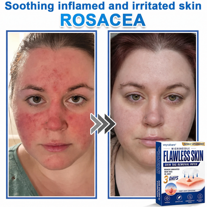 💎veyrabare® 2026 Newly Upgraded 2-in-1 Microneedle Hydrocolloid Patches | Removes Raised Moles, Acne, Flat Warts, and Skin Tags | Improves Wrinkles, Scars, and Blemishes | Invisible Acne Patches for Face & Body