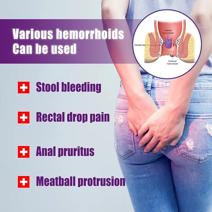 Stop Letting Hemorrhoids Affect Your Day